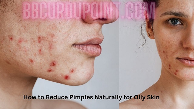 How to Reduce Pimples Naturally for Oily Skin